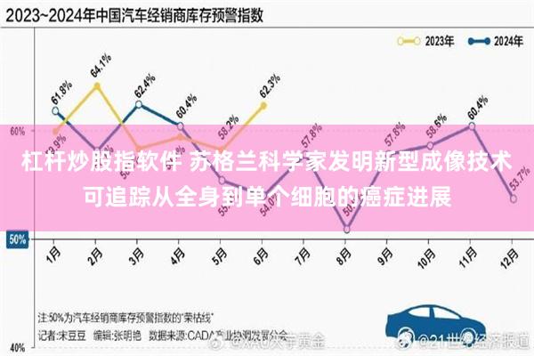 杠杆炒股指软件 苏格兰科学家发明新型成像技术可追踪从全身到单个细胞的癌症进展